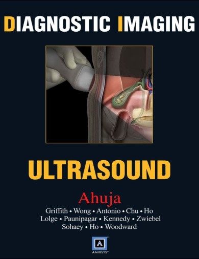 Diagnostic Imaging: Ultrasound