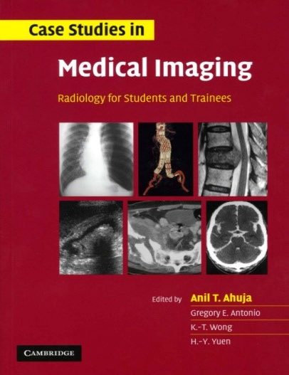 Case Studies in Medical Imaging: Radiology For Students and Trainees