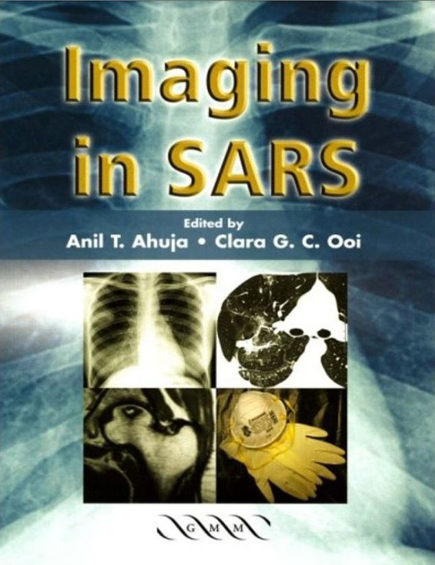 Imaging in SARS